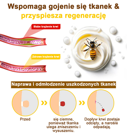 ✅flysmus™ Krem leczniczy z jadem pszczelim🐝: Leczenie egzemy, łuszczycy, trądziku, trądziku różowatego, infekcji grzybiczych, brodawek