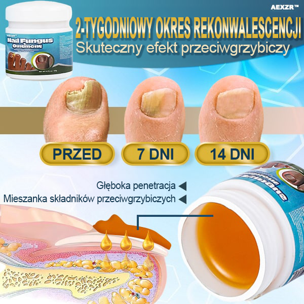 ✨Aexzr™ 5X Szybko leczący grzybicę paznokci Ointment👨🏼‍⚕️British Zatwierdzony przez dermatologa