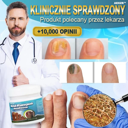 ✨Aexzr™ 5X Szybko leczący grzybicę paznokci Ointment👨🏼‍⚕️British Zatwierdzony przez dermatologa