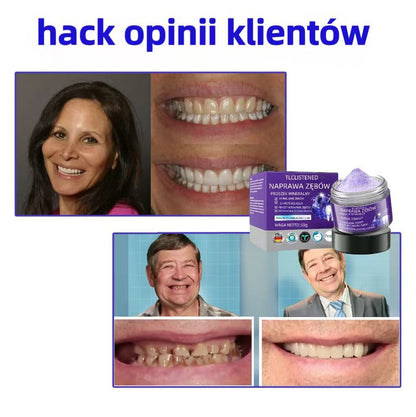 Oficjalny sklep 🏥 TLCLISTENED™ Proszek mineralny do odbudowy zębów (zalecany przez ADA) WYPRODUKOWANY W USA