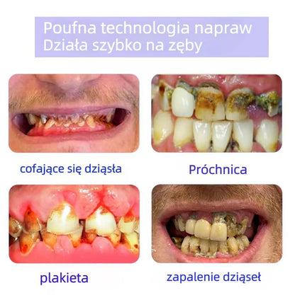 Oficjalny sklep 🏥 TLCLISTENED™ Proszek mineralny do odbudowy zębów (zalecany przez ADA) WYPRODUKOWANY W USA